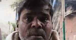 बकाया पैसा मांगने गए युवक को चाकू मारने का आरोप